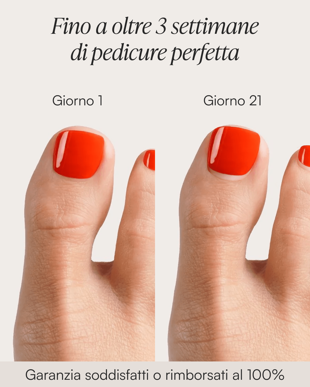 Estate Set Pedicure Estivo Iniziale - Strisce in Gel - Doonails Italy