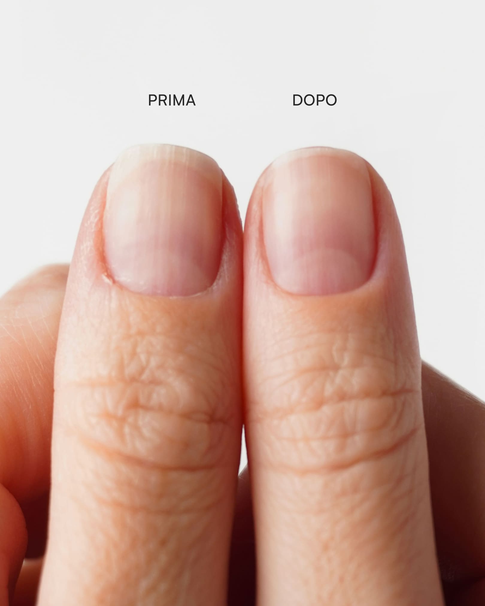 Tronchesina per cuticole